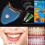 Heimgebrauch Zahnaufhellung Bleaching Squishies Squishy Gel Kit 2