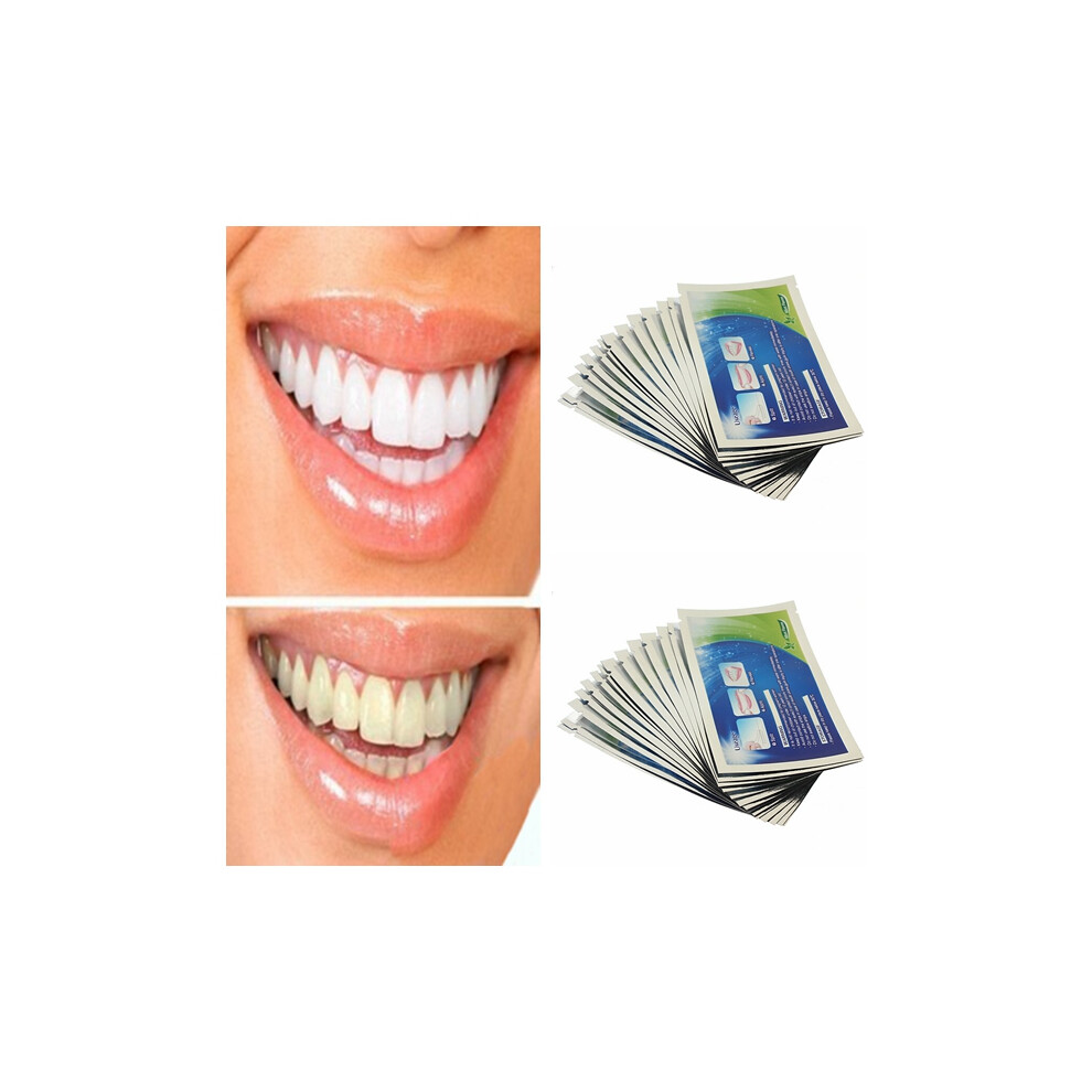 2 Packs Teeth Whitening Strips Home Dental Bleaching Whiter