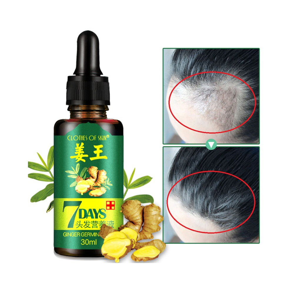 Orange 30Ml Hair Loss Treatment Ginger Hair Growth Essence Hair Care