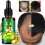 30 ml Haarausfallbehandlung Ingwer Haarwachstumsessenz Haarpflege 2