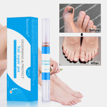 3 - delige Nagelverzorgingsvloeistof Nagelherstelpen