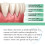 Dentizen Gum Regrowth Drops 2