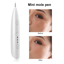 Skin Tag Remover Laser Plasma Multi-functional Portable Dark Spot Remover Tool Pen Beauty Equipment