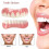 Extra Thin Fake Bright White Tooth Veneers Silicone Soft Safe Adhesive Denture Hide Shade Braces Comfortable Teeth Orthodontic 2