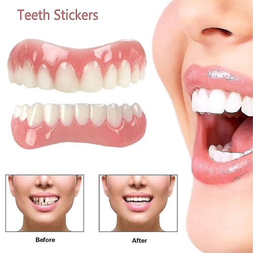 Extra Thin Fake Bright White Tooth Veneers Silicone Soft Safe Adhesive Denture Hide Shade Braces Comfortable Teeth Orthodontic 1