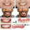 Extra Thin Fake Bright White Tooth Veneers Silicone Soft Safe Adhesive Denture Hide Shade Braces Comfortable Teeth Orthodontic 4