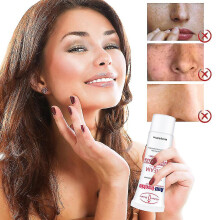 Niacinamide Anti-freckle Cream Facial Brightening Moisturizing Skin Care