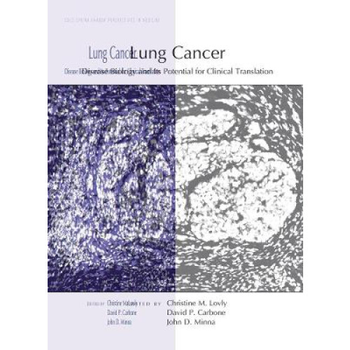 Lung Cancer