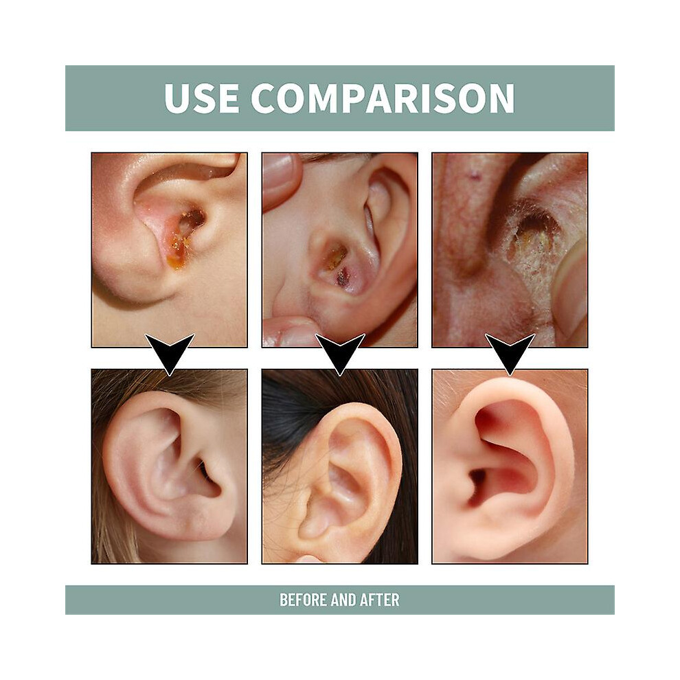 Anti Tinnitus Earwax Removal Spray Ear Wax Remover Cleaner For Tinnitus Relief