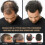 Root Activator Shampoo, Hair Loss Shampoo,Shampoo Root Activator 5