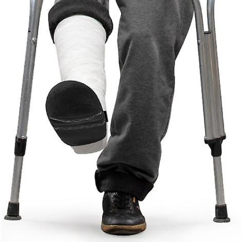 Cast Sock For Plaster Cast - Keeps Toes Warm, Clean, And Protected
