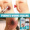 Medical Glue For Cuts, Fast-drying 2