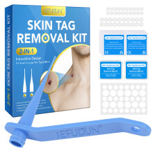 (SF simple blue) Simple Wart Removal, Removal Of Skin Tags, Large And Small Warts, Corns, Thorns, Warts, Flattening Of Plantar Flesh, Removal Of Warts