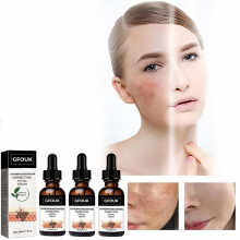 3pcs Gfouk Melanin Correcting Facial Serum, Discoloration Correcting Serumdark Spot Corrector Daily Face Serum
