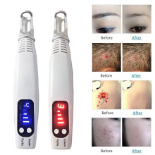 Home Portable Picosecond Tattoo Removal Pen Fit For Mole Dark Spot Acne Scar