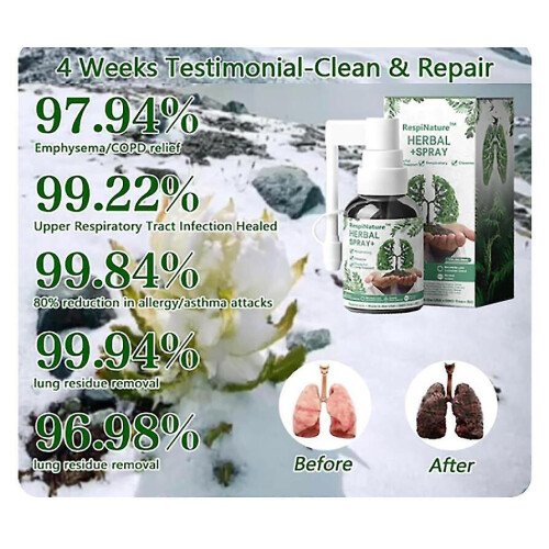 Respinature Herbal Lung Cleanse Mist-powerful Lung Support,30ml Herbal Spray 2