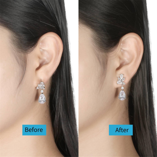 8PCS Earring Backs for -Ears,Gold 1
