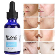 Glycolic Acid Peel 70% Stock Solution 30ml - Brighten Skin, Refine Pores, Acne Treatment, Gentle and Non-Irritating mxbc