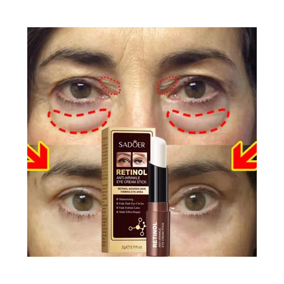 Instant Eye Bag Removal Cream Collagen Anti-Wrinkle Fade Fine Lines