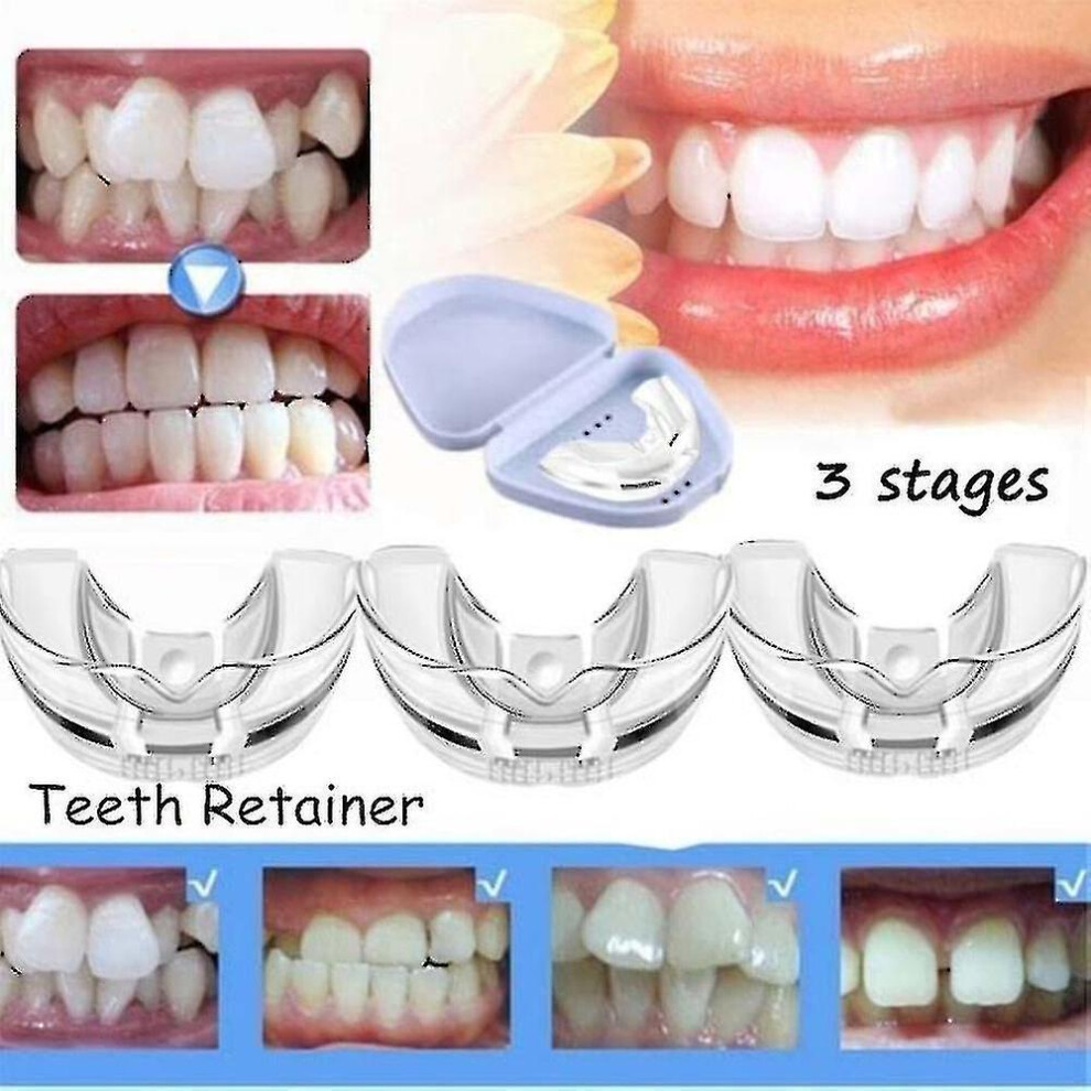 3pcs Dental Braces Orthodontic Teeth Trainer Set For Adults Orthotics Tooth Retainers Alignment 3 Phases Teeth Straightener Z2g