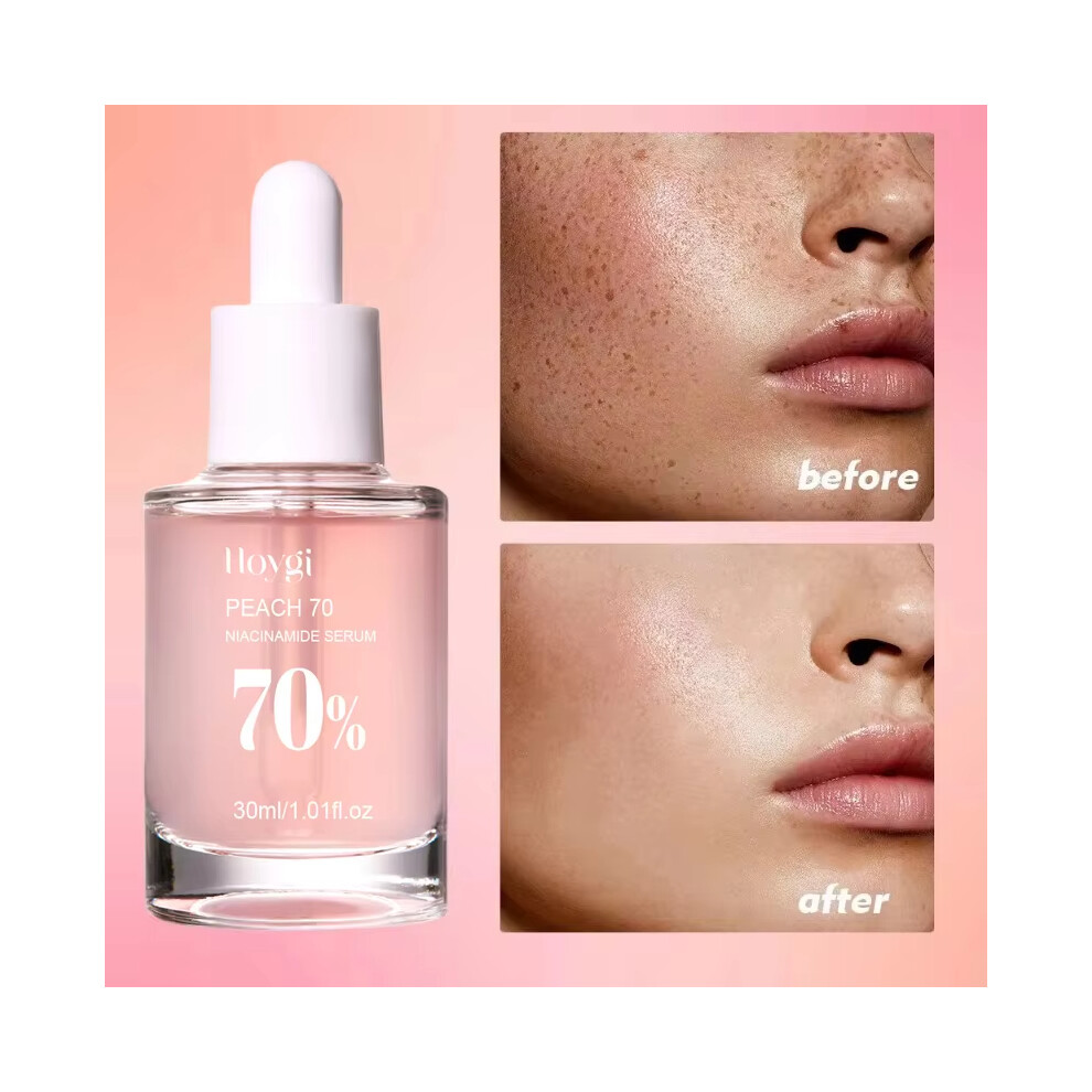 Peach 70% Niacinamide Serum 30ml