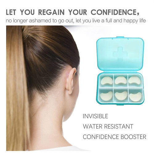 6pcs Cosmetic Ear Corrector Protruding Ear Solution Elf Ear Patches 1