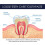 EELHOE  Ginseng propolis toothpaste 3