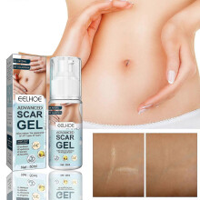Eelhoe Scar Removal Gel