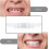 Smile Snap On False Teeth Upper 4