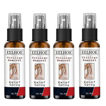 4x Herbal Extract Vitiligo Spray Remove Ringworm White Spot Removal Skin White Spot Treatment Spray