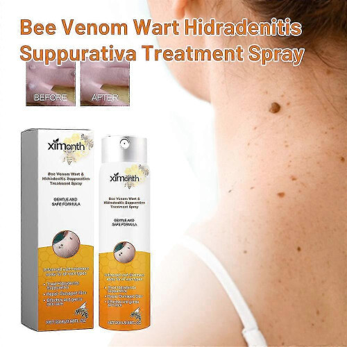 (3pcs) Bee Venom For Warts And Papillomas 1