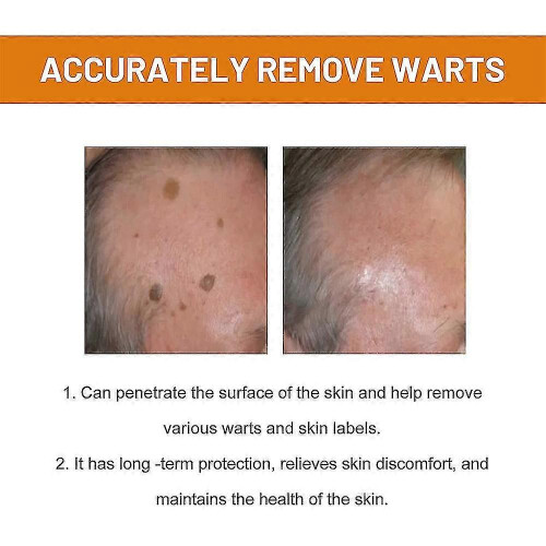 (3pcs) Bee Venom For Warts And Papillomas 2