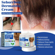 SRJ STAR Seborrheic Dermatitis Cream Hoofdhuid Behandeling Voor Psoriasis Kalmerende Hydraterende