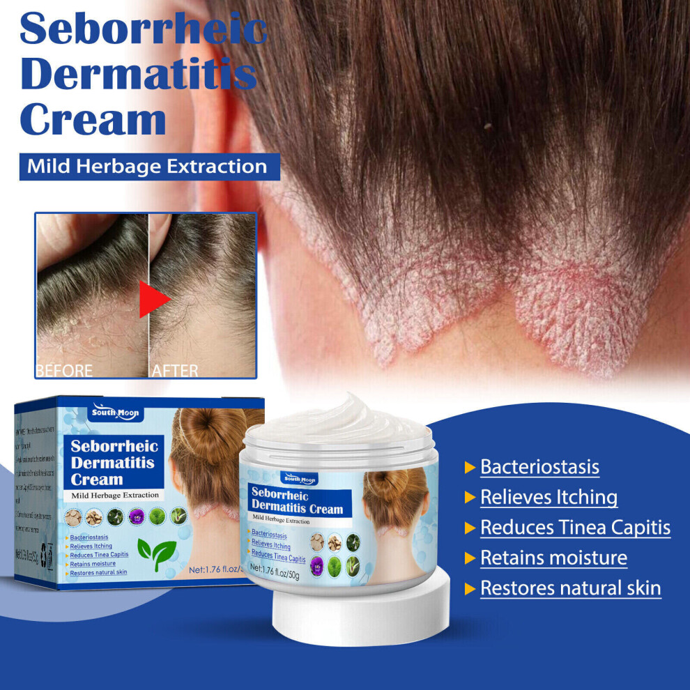 Srj Star Seborrheic Dermatitis Scalp Treatment For Psoriasis Soothing Moisturizing Cream