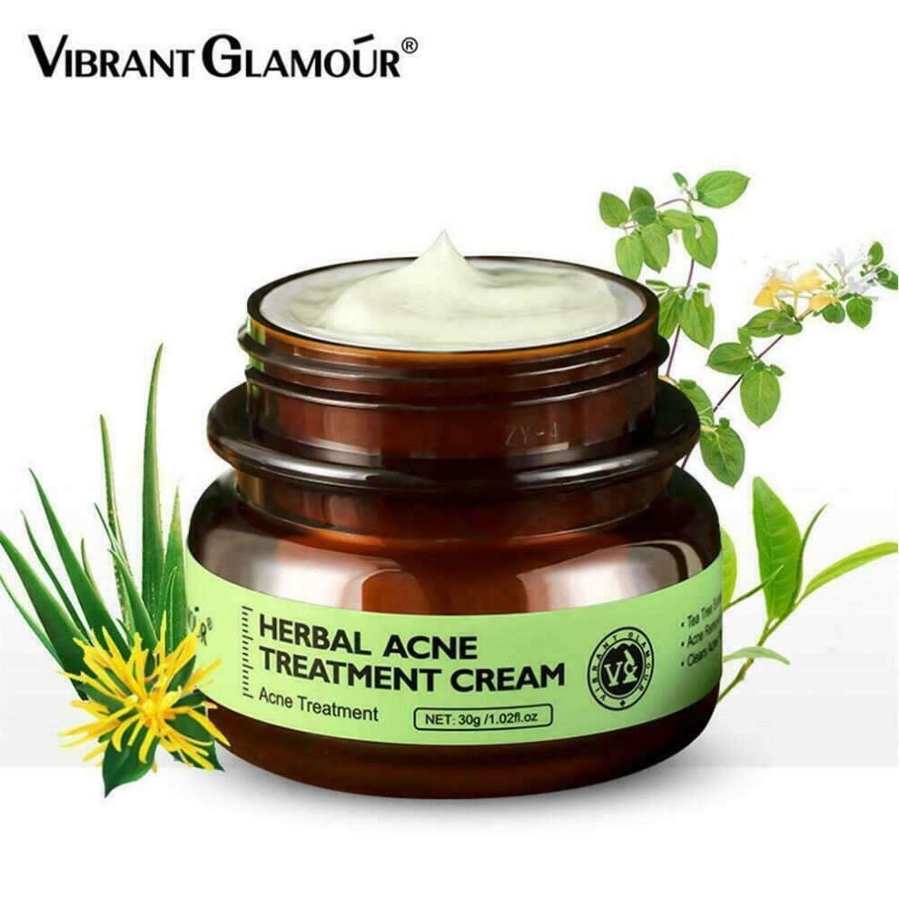 Anti acne cream Herbal scar removal oily skin Acne care