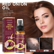 SKESRJTOP Rote Zwiebel Öl für Haarwachstum & Schuppen, Haarausfall Kontrolle für geschädigtes Haar
