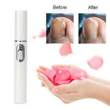 Anti-schimmel Home Behandeling Set Laser Pen Vinger Teen Nail Fungus Care Kit