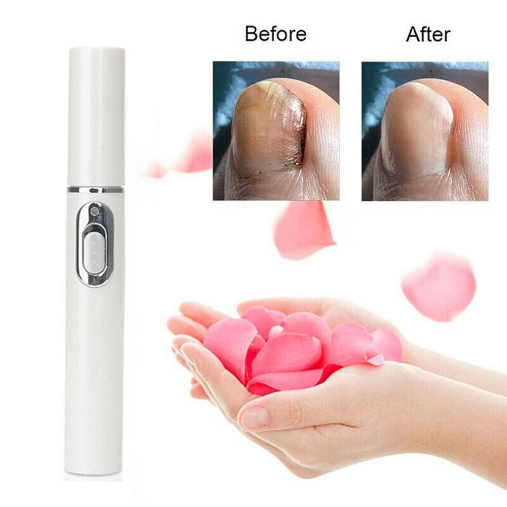Blue Anti-Fungal Home Treatment Set Laser Pen Finger Toe Nail Fungus Care Kit