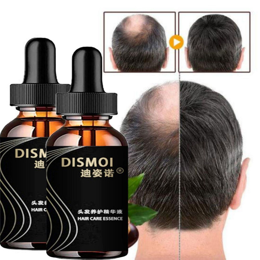 (50ml) Anti Alopecia Hair Growth Serum Essential Oil Anti Hair Loss Spray Products Ginger Treatment Dry Frizzy Damaged