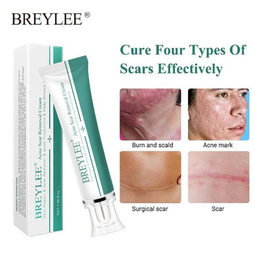 (white, 30g) Reduces Old & New Scar Removing Gel Scar Removal Cream Acne Removal Stretch Mark Remover For Men & Women Acne Scar Removal