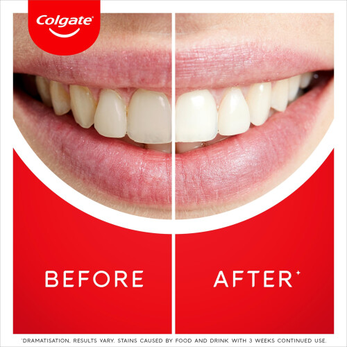 Colgate Max White Ultra Active Foam Toothpaste, At Home Whitening Toothpaste Clinically Proven Whiter Teeth in 3 Days*, Toothpaste Multipack, 2 Pack, 75ml 2
