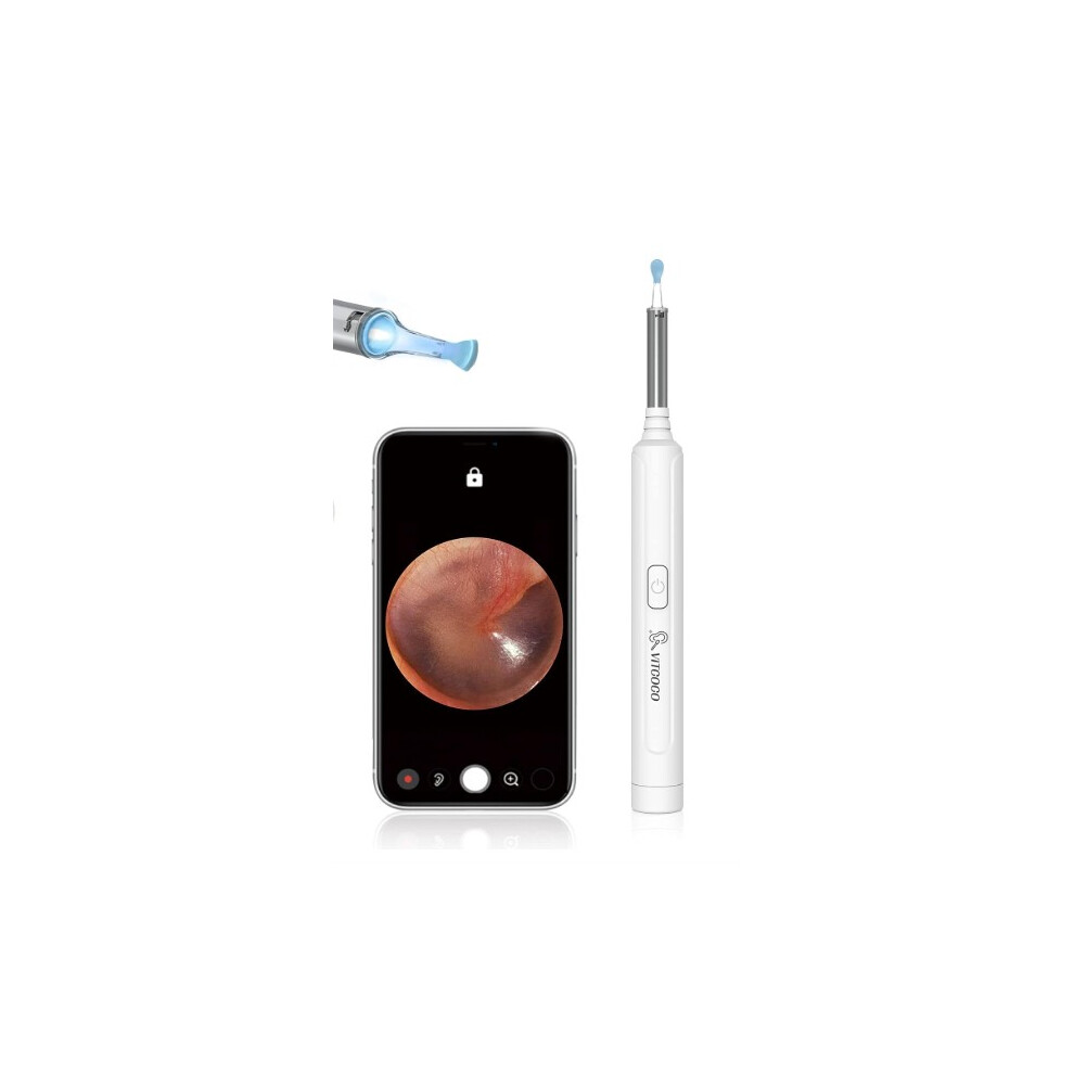 ÂVitcoco (Type B) Ar Wax Removal Kit Ear Camera 1920P Fhd Wireless Ear Cleaner Ear Wax Remover With 8 Pcs Ear Spoon, 3.9Mm Waterproof Ear Otoscope Endoscope