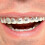 Billy Bob Fool-All Braces 4