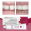 Cushion Grip Thermoplastic Denture Adhesive/Soft Reliner 1oz 28g 2