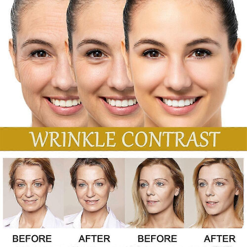 3x Advanced Bee-venom Serum Anti-aging Moisturizer for Face And Neck 2