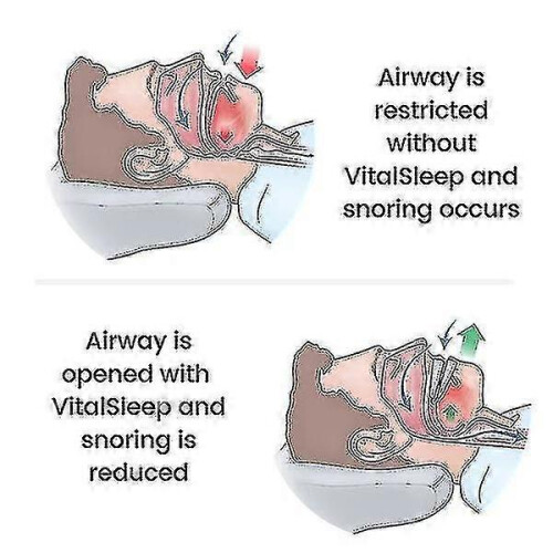 Adjustable Mouth with Silicone Anti-snoring Device 2
