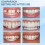 30ml Moldable False Teeth White Particles Reusable Non-toxic Temporarily Fill Regain Smile 3