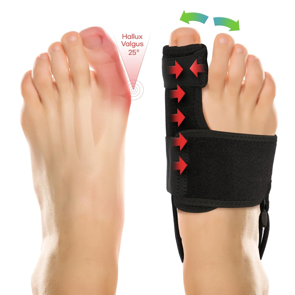 Etruston Bunion Corrector For Women And Men: Orthopedic Bunion Splint