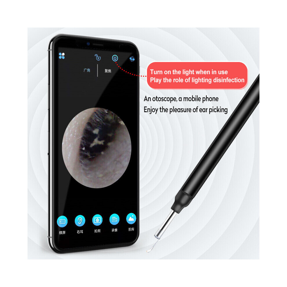 Etruston Wireless Earwax Remover Otoscope For Adults Kids & Pets