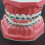 Dentalmall Typodonts Ορθοδοντικής Μοντέλο Επίδειξης με Μεταλλικά Καλώδια και Στηρίγματα 5